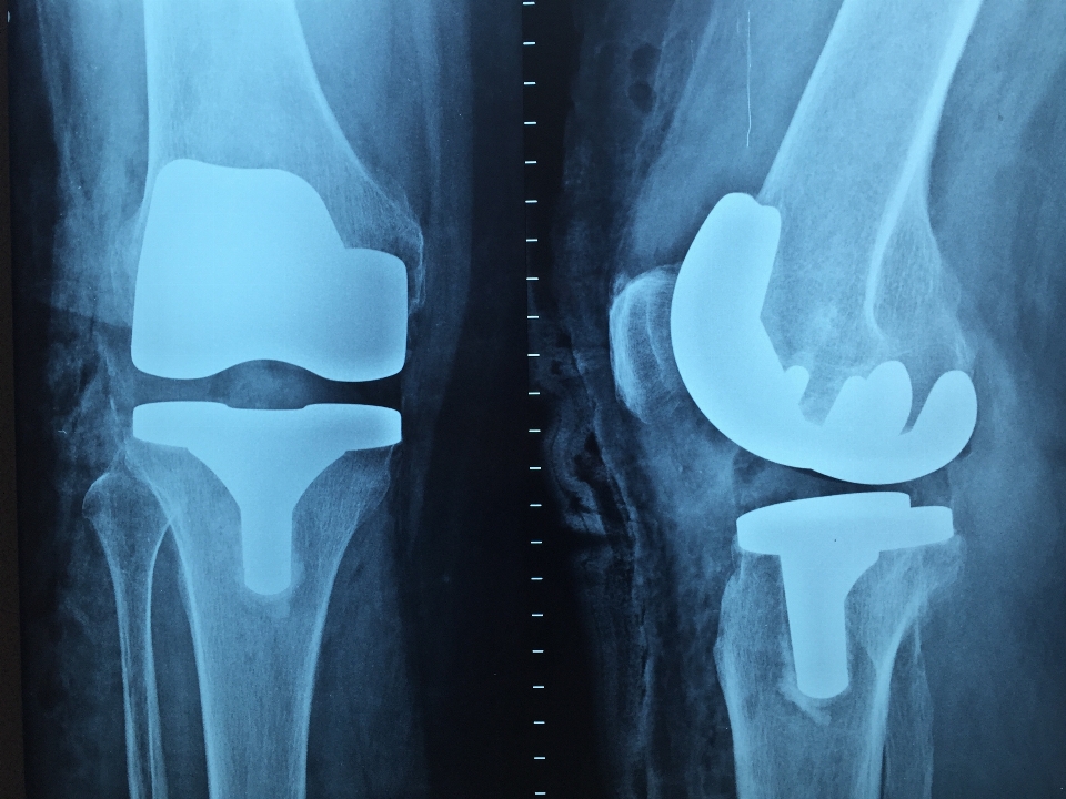 Stamm arm brust menschlicher körper
