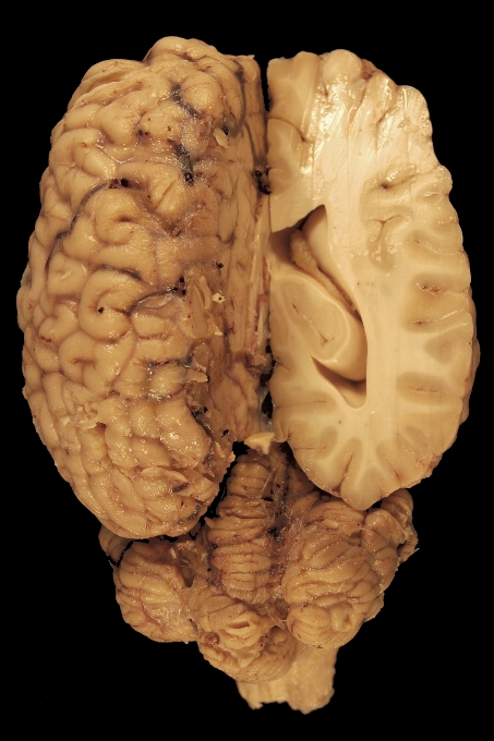 Biologi kuda tubuh manusia
 mata