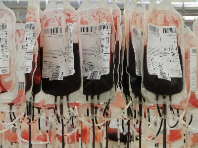 Red electrical wiring blood bags cells Photo